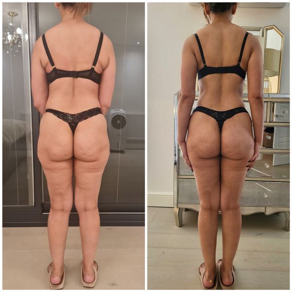 Transformation - Josie Q.